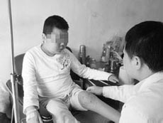 强直性脊柱炎是哪些因素引起的 强直性脊柱炎是哪些因素引起的