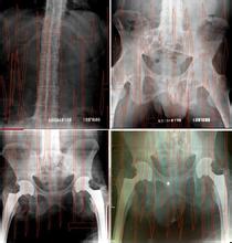 强直性脊柱炎 锻炼及加强预防 强直性脊柱炎 锻炼及加强预防