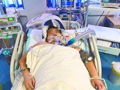 300斤胖哥因天热引发脑出血 休克倒地 300斤胖哥因天热引发脑出血 休克倒地