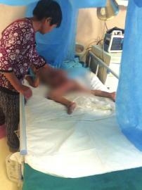 3岁男孩坐进稀饭锅 臀部严重烫伤 3岁男孩坐进稀饭锅 臀部严重烫伤