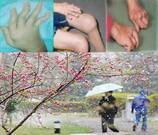 春季到来,风湿免疫病病发高峰期 春季到来,风湿免疫病病发高峰期