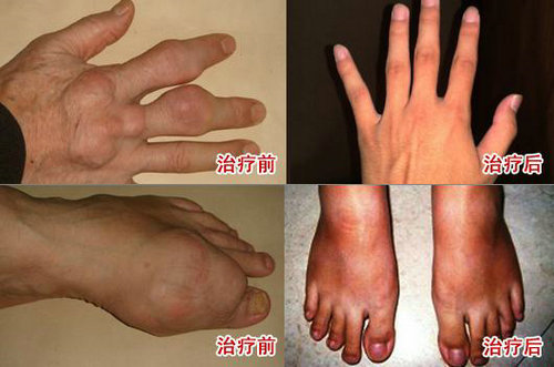 ʹܱҽԺЧ ֣ʹʪҽԺٴ 