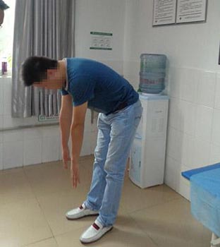 强直错误治疗病情加重，郑州痛风风湿病医院专业治疗助他重拾健康