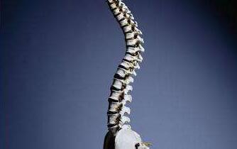 强直性脊柱炎预防 强直性脊柱炎的确诊不容忽视!