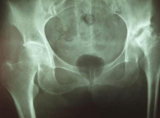 郑州痛风风湿病骨科医院好不好.jpg 郑州痛风风湿病骨科医院好不好