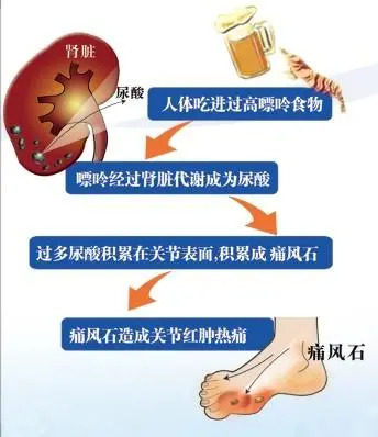 ֣ʹרҵҽԺʹϼٴ֢״ֱʲô