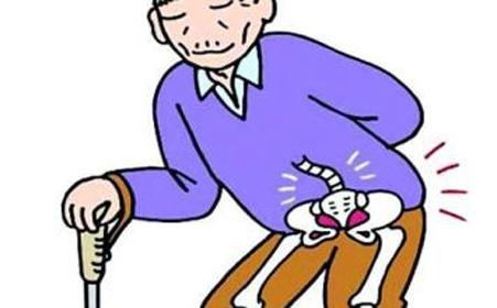 郑州风湿专治专家:滑膜炎就要及时进行治疗